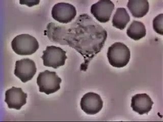 "LÖKOSİTİN  BAKTERİYİ KOVALAMASI"Soner  GENEL