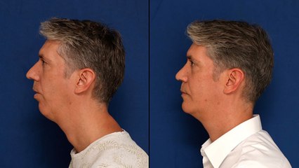 Doctor César Casado: "En España, la clase media se opera más que los famosos"