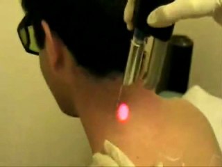 Botox cosmetic treatments Center Bethlehem