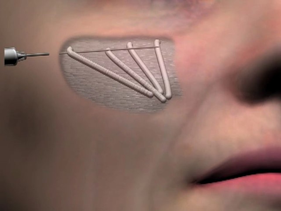 Chirurgie, médecine, laser esthétique www.chirurgie-nice.com