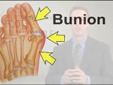 Bunion Treatment - Podiatrist Kansas City, Lee's Summit, MO and Overland Park, KS