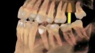Cosmetic Dentist | Reconstructive Dentistry | Pretoria | Dr Ade Meyer