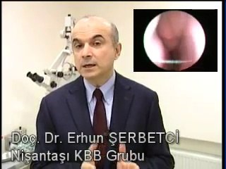 Her Burun Tıkanıklığı Ameliyat Gerektirmiyor