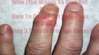 Natural Remedies For Gout Pain - how to remove gout crystals