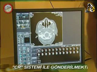 Sungurlu Devlet Hastanesi'ni Tanıyalım...