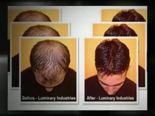 Botox Treatment- Royal Palm Wellness at Bigmouthlocal.com