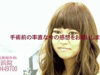 品川美容外科 横浜院　簡単にお鼻のコンプレックス解消!