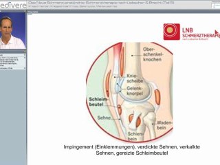 LNB-bei-Knieschmerzen-Teil-3