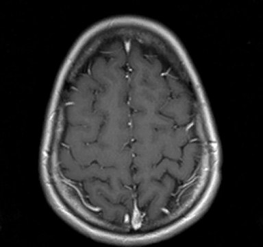 irm crane video proposée par le service de radiologie lyon nord