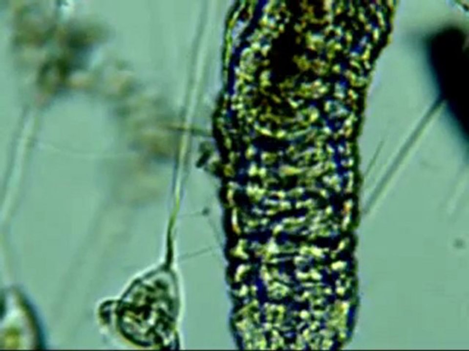 multicellulaire et vorticelles