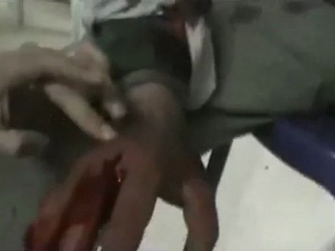 فري برس حمص الرستن اصابة بالوريد 24 2 2012