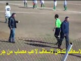 لاعب من ح جرسيف يصاب في رأسه