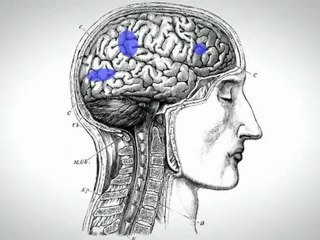 Alexia sin agrafia: Howard Engel (Oliver Sacks)