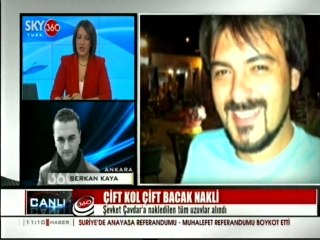 Çift Kol Çift Bacak Nakli