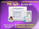 TB IgG ELISA kit