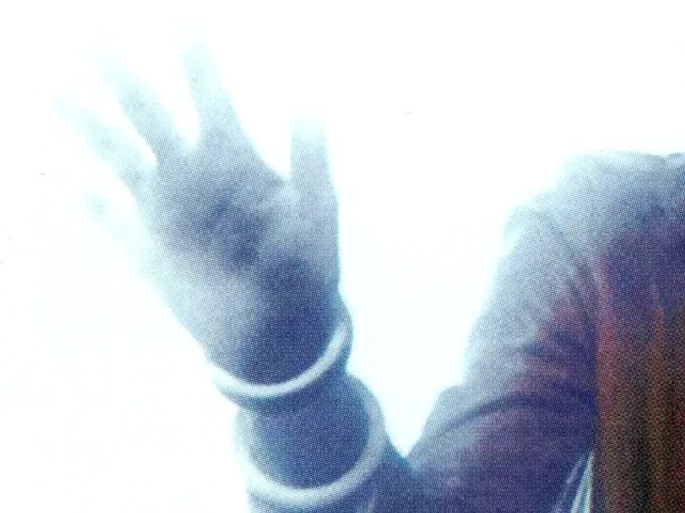 J-ES (J.P.R.1981)