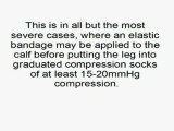Help Your Calf Strain With Compression Socks