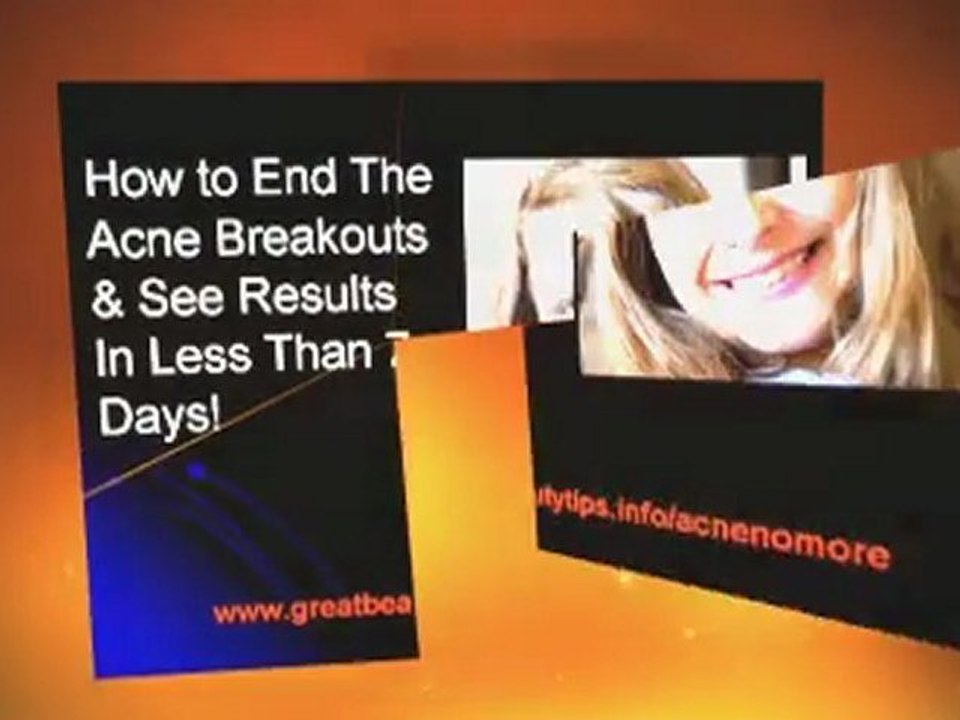 How to remove acne on face fast. How to stop acne breakouts naturally.