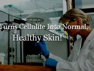 Cellulite Massage?-What Will Really Help!