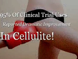 Cellulite Reduction Diet-Will This Help?