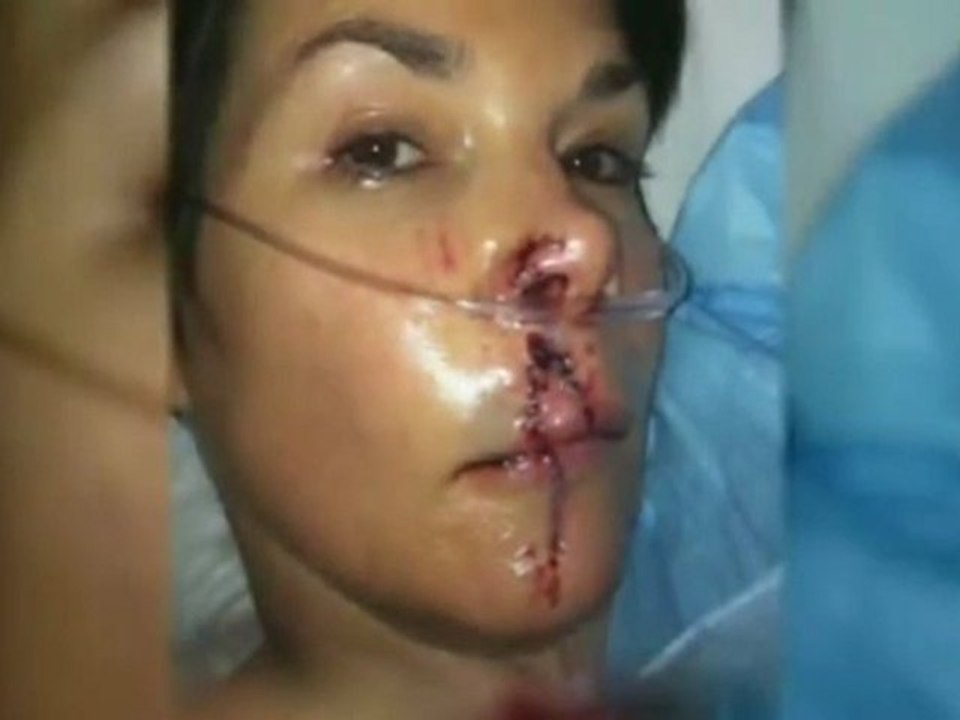 Interview avec la journaliste mordu par un chien à la TV