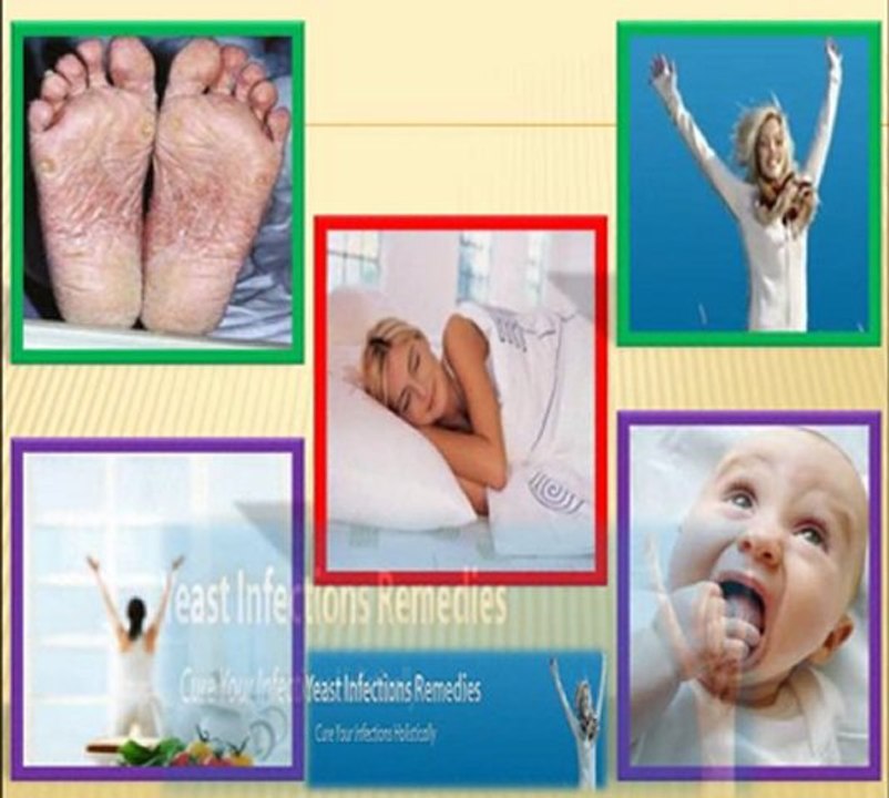 Home Remedies For Yeast Infection