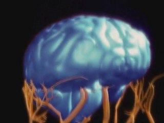 Conséquences du "jeu" du foulard: l'aspect fonctionnel