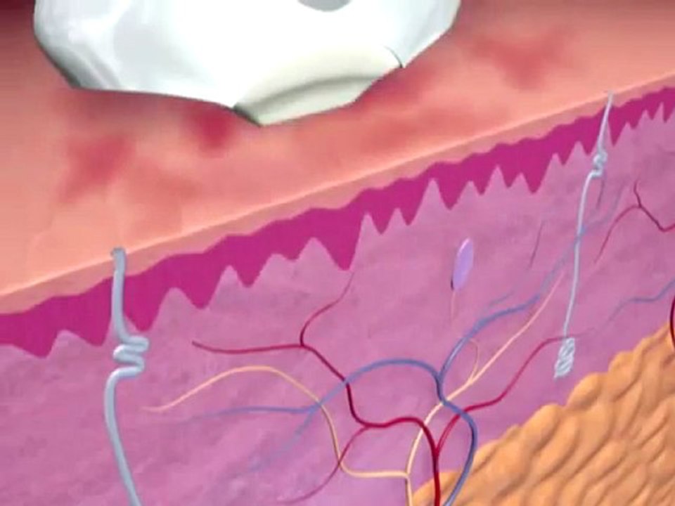 IPL Photofacial | Skin Rejuvenation | www.FLMedSpa.com