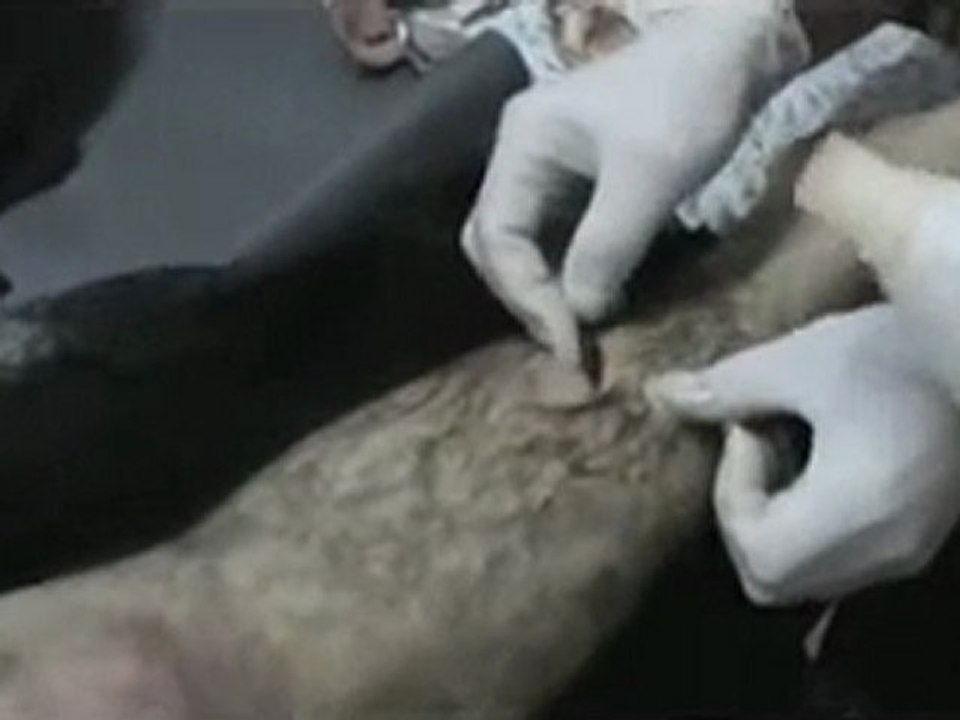 فري برس   حمص البياضة أحد أصابات في الحي من قبل حاجز المكاتب