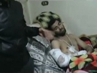 فري برس   الناشط ملهم الجندي يشرح لنا كيف اصابة احد المواطنين