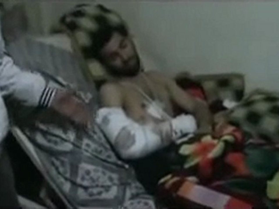 فري برس   الناشط ابو جعفر  يشرح لنا كيف اصابة احد المواطنين