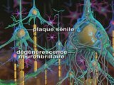 Maladie d Alzheimer Symptômes Définition Diagnostic Traitements