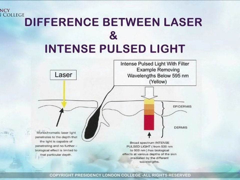 The Difference Between Laser and Intense pulsed light