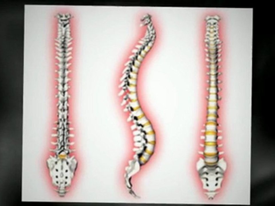 Lower Back Pain Relief Machine | The Back Bubble