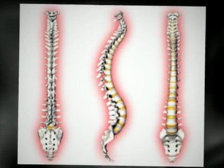 Lower Back Pain Relief Machine | The Back Bubble