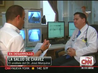 Doctor José Marquina asegura que presidente Chávez recibirá quimioterapia