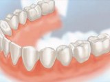 Dental Crowns Libertyville IL - Tooth Crowns Libertyville IL - Libertyville IL Porcelain Crowns