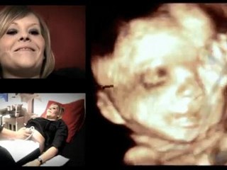 Bébé Art Echo - Echographie 3D Nord