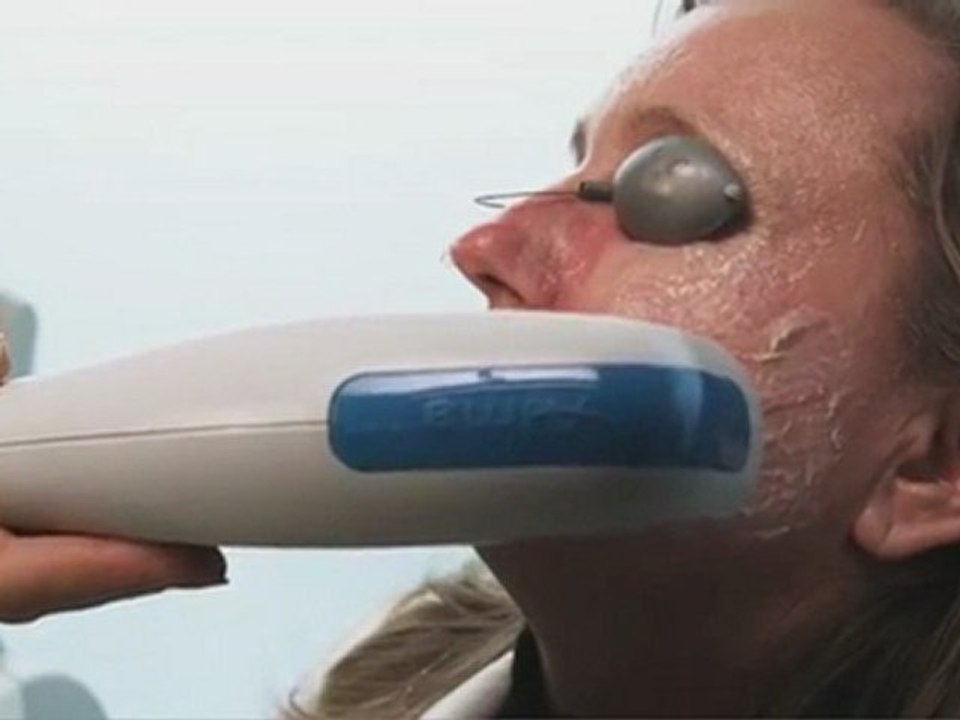 DermFx Photofacial Procedure Get Your DermFx Photofacial Procedure Call 562-592-5100