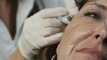 DermFx Fillers Learn More About DermFx Fillers Call 562-592-5100