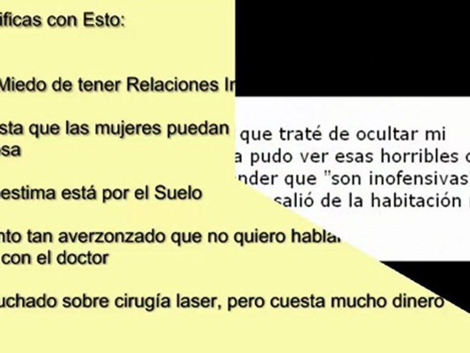 Papulas Perladas Jamas--[Como Removerlas Tratamiento Casero]
