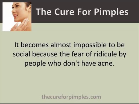 Best Adult Acne Treatment - Clear Skin Max-A Six Step System Can Really Help Clear Up Pimples