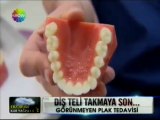 İlke Elgün Show TV Ana Haber Diş Teli Takmaya Son