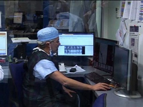 27 suboccluded left internal carotid lesion flow reversal moma device incathlab.com