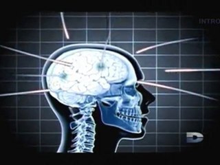 Bizarre ou quoi, La force de l'esprit - 2 de 3