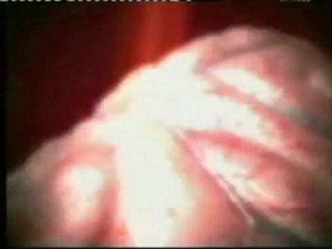 Marihuana: Efectos fisiologicos