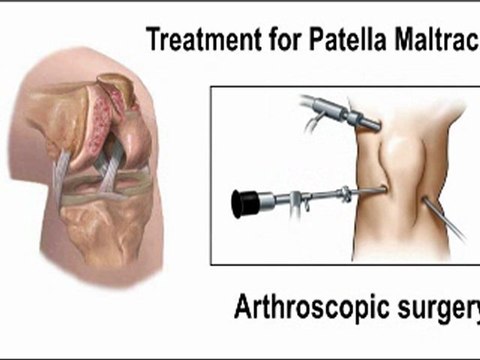 Knee Pain - Orthopedist - Manahawkin, Barnegat, Little Egg Harbor, NJ