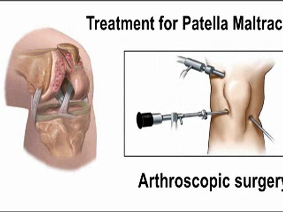 Knee Pain - Orthopedist - Manahawkin, Barnegat, Little Egg Harbor, NJ