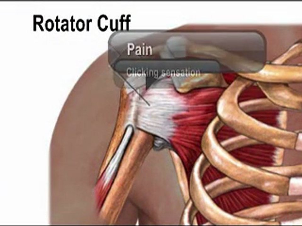 Shoulder Pain - Orthopedist - Manahawkin, Barnegat, Little Egg Harbor, NJ