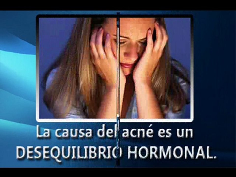 [como quitar el acne rápido] eliminar acne